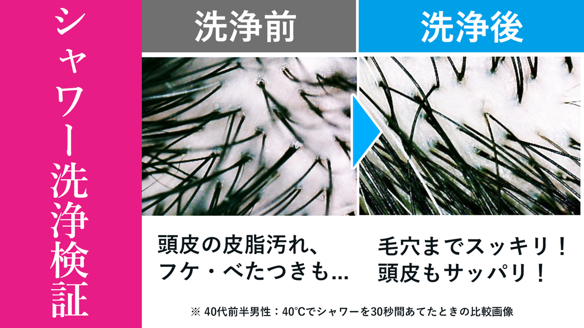 生ナノバブルシャワーヘッド｜爽快感あるジェットミスト水流で頭皮洗浄・肌ケアも | TIMELINE（タイムライン）